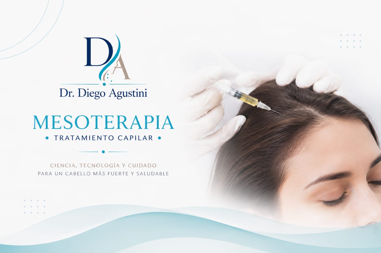 Mesoterapia