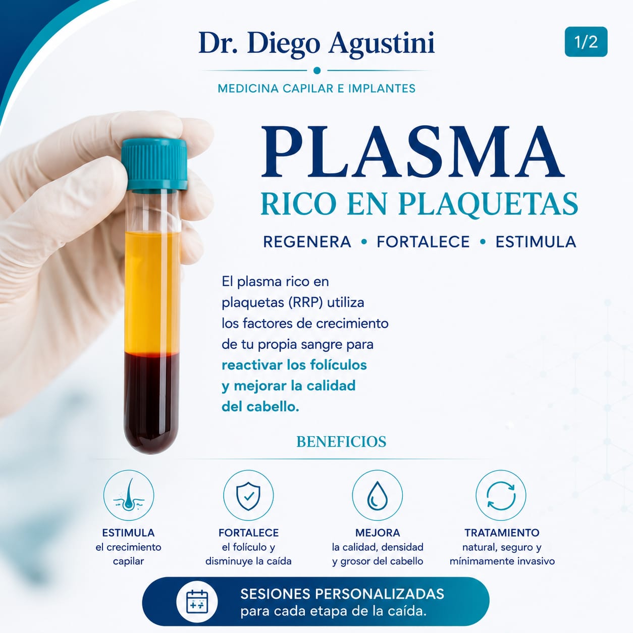Plasma rico en plaquetas (PRP)